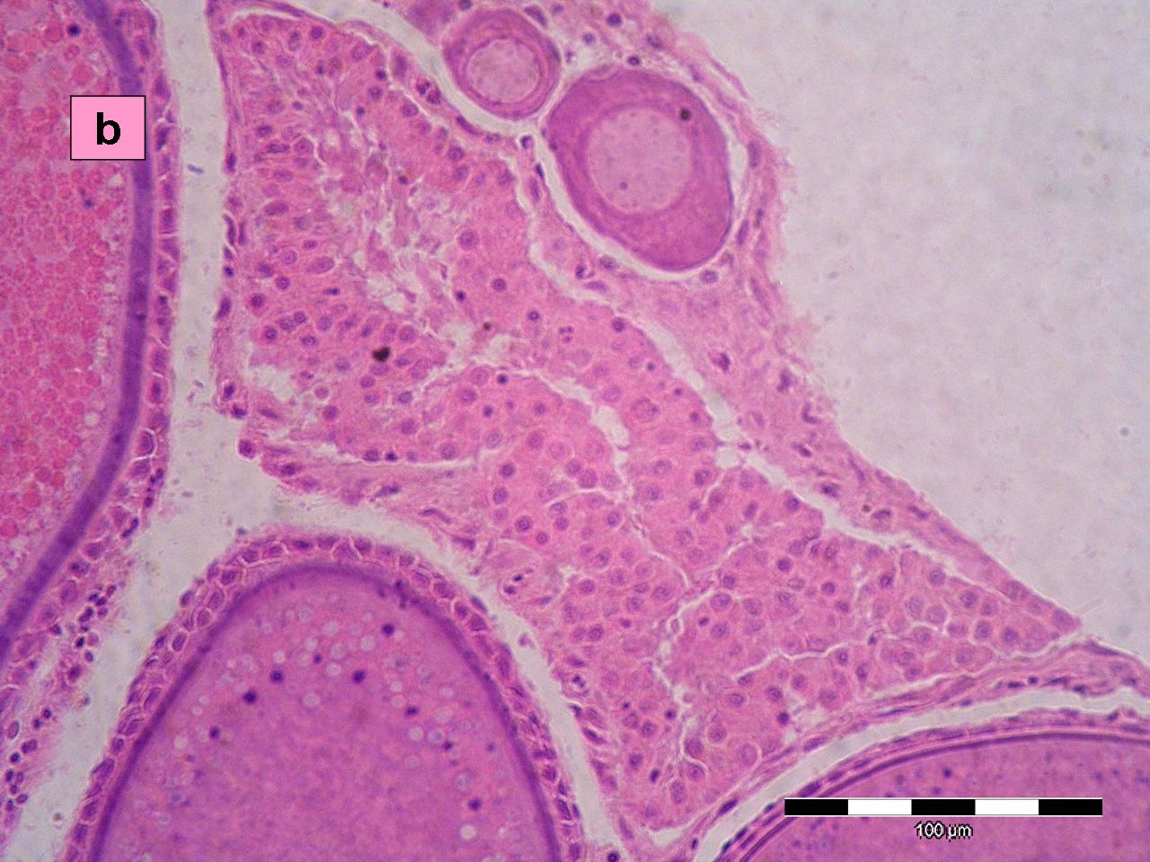 RIM17(8)